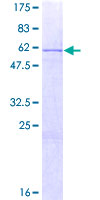 ab153085 on a 12.5% SDS-PAGE stained with Coomassie Blue.