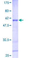 ab158677 on a 12.5% SDS-PAGE stained with Coomassie Blue.