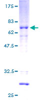 ab158685 on a 12.5% SDS-PAGE stained with Coomassie Blue.