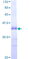 ab158686 on a 12.5% SDS-PAGE stained with Coomassie Blue.