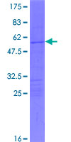 ab158682 on a 12.5% SDS-PAGE stained with Coomassie Blue.