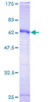 ab158683 on a 12.5% SDS-PAGE stained with Coomassie Blue.