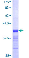 ab158690 on a 12.5% SDS-PAGE stained with Coomassie Blue.