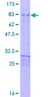 ab158688 on a 12.5% SDS-PAGE stained with Coomassie Blue.