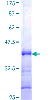 ab158689 on a 12.5% SDS-PAGE stained with Coomassie Blue.