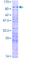 ab162358 on a 12.5% SDS-PAGE stained with Coomassie Blue.