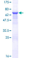 ab164580 on a 12.5% SDS-PAGE stained with Coomassie Blue.