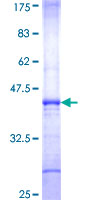 ab164581 on a 12.5% SDS-PAGE stained with Coomassie Blue.