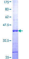 ab164119 on a 12.5% SDS-PAGE stained with Coomassie Blue.