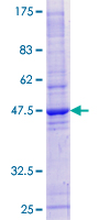 ab163486 on a 12.5% SDS-PAGE stained with Coomassie Blue.