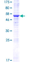 ab165131 on a 12.5% SDS-PAGE stained with Coomassie Blue.