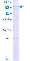 ab158701 on a 12.5% SDS-PAGE stained with Coomassie Blue.