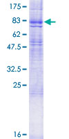 ab158699 on a 12.5% SDS-PAGE stained with Coomassie Blue.