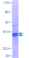 ab158700 on a 12.5% SDS-PAGE stained with Coomassie Blue.