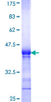 ab161380 on a 12.5% SDS-PAGE stained with Coomassie Blue.