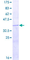 ab153469 on a 12.5% SDS-PAGE stained with Coomassie Blue.