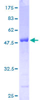 ab163821 on a 12.5% SDS-PAGE stained with Coomassie Blue.