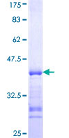 ab160468 on a 12.5% SDS-PAGE stained with Coomassie Blue.