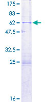 ab161775 on a 12.5% SDS-PAGE stained with Coomassie Blue.