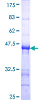 ab158706 on a 12.5% SDS-PAGE stained with Coomassie Blue.