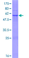 ab158703 on a 12.5% SDS-PAGE stained with Coomassie Blue.