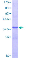 ab158704 on a 12.5% SDS-PAGE stained with Coomassie Blue.