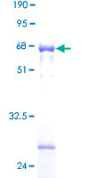 ab152898 on a 12.5% SDS-PAGE stained with Coomassie Blue.