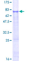 ab164773 on a 12.5% SDS-PAGE stained with Coomassie Blue.