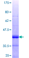 ab164774 on a 12.5% SDS-PAGE stained with Coomassie Blue.