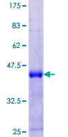 ab165715 on a 12.5% SDS-PAGE stained with Coomassie Blue.