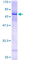 ab164703 on a 12.5% SDS-PAGE stained with Coomassie Blue.