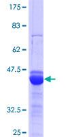 ab164704 on a 12.5% SDS-PAGE stained with Coomassie Blue.