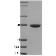 15% SDS-PAGE gel loaded with recombinant human Hsp27 protein.