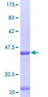 ab158708 on a 12.5% SDS-PAGE stained with Coomassie Blue.