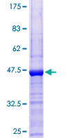 ab162528 on a 12.5% SDS-PAGE stained with Coomassie Blue.