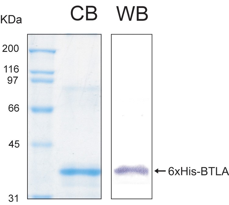 Human BTLA (B- and T-lymphocyte attenuator) recombinant protein
