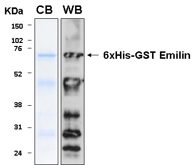 Human EMILIN1 (Emilin 1) recombinant protein 6xHis-GST tagged