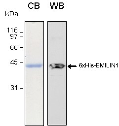 Human EMILIN1 (Emilin 1) recombinant protein 6xHis tagged