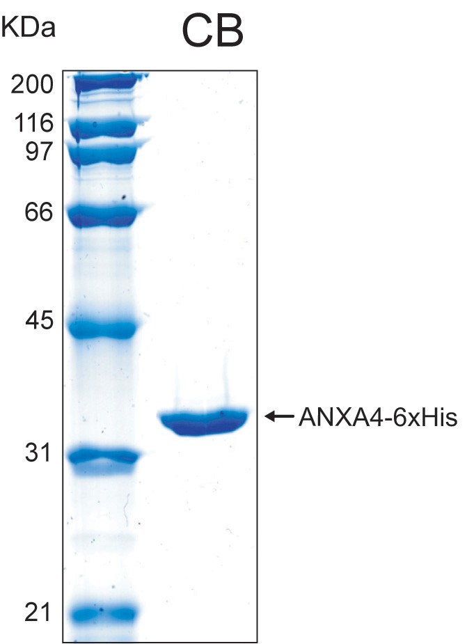 Human ANXA4 (Annexin A4) recombinant protein