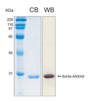 Human ANXA9 (Annexin A9) recombinant protein
