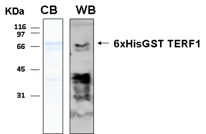 Human TERF1 (Telomeric repeat-binding factor 1) recombinant protein 6xHis-GST tagged