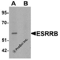 Western blot analysis of ESRRB in human heart tissue lysate with ESRRB antibody at 1 μg/mL in (A) the absence and (B) the presence of blocking peptide.