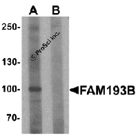 Western blot analysis of FAM193B in Jurkat cell lysate with FAM193B antibody at 1 μg/mL in (A) the absence and (B) the presence of blocking peptide.
