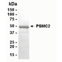 SDS PAGE: Analysis of PSMC2 Recombinant Protein. 4-20% SDS gradient gel. Coomassie blue staining.