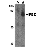 Western blot analysis of FEZ1 in SK-N-SH cell lysate with FEZ1 antibody at 1 μg/mL in the (A) presence and (B) absence of blocking peptide.