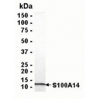 SDS PAGE: Analysis of S100A14 Recombinant Protein. 4-20% SDS gradient gel. Coomassie blue staining.