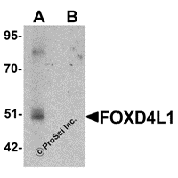 Western blot analysis of CASKIN2 in Hela cell lysate with CASKIN2 antibody at 1 μg/mL in (A) the absence and (B) the presence of blocking peptide.