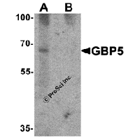 Western blot analysis of GBP5 in rat liver tissue lysate with GBP5 antibody at 1 μg/mL in (A) the absence and (B) the presence of blocking peptide.