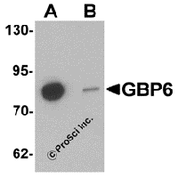 Western blot analysis of GBP6 in Hela cell lysate with GBP6 antibody at 0.5 μg/mL in (A) the absence and (B) the presence of blocking peptide.