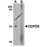Western blot analysis of GDPD5 in mouse kidney tissue lysate with GDPD5 antibody at 1 μg/ml in (A) the absence and (B) the presence of blocking peptide.